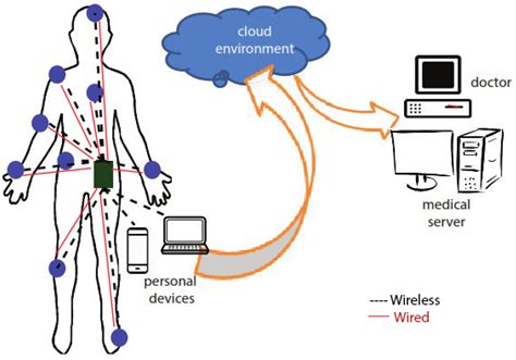 wireless body sensor system